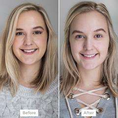 Before and After pic after using We Love Eyes Tea Tree Eyelid Foaming Cleanser